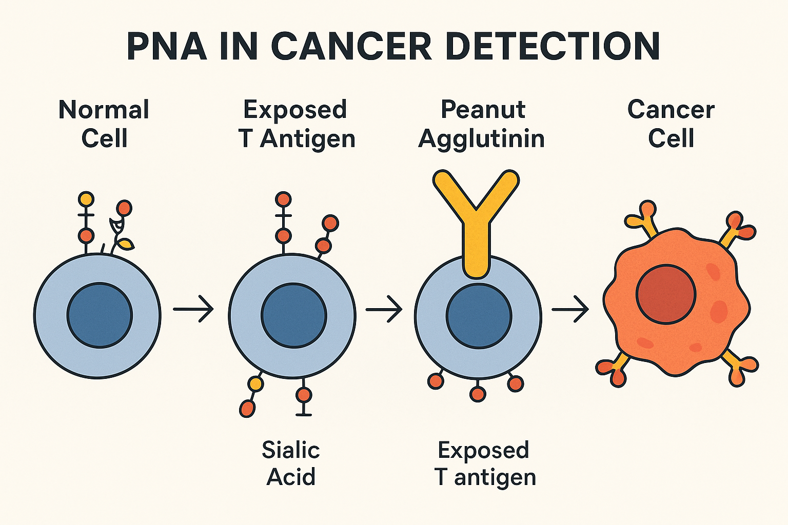 Role of Peanut Agglutinin in Cancer Detection